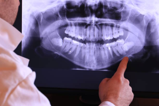 Best Cracked Tooth Emergency Dentist  in Redlands, CO